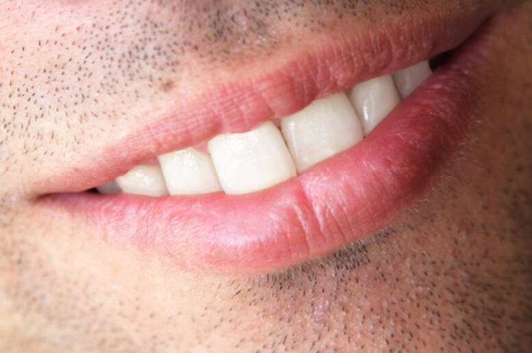 I simboli dei sogni - La caduta dei denti è la perdita di energia